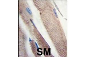 Formalin-fixed and paraffin-embedded human skeletal muscle tissue reacted with PI3KC3 Antibody , which was peroxidase-conjugated to the secondary antibody, followed by DAB staining. (PIK3C3 antibody  (AA 831-856))