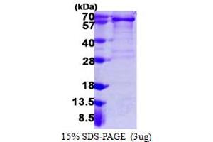 SDS-PAGE (SDS) image for Platelet Derived Growth Factor Receptor alpha (PDGFRA) (AA 24-524) protein (His tag) (ABIN6386789) (PDGFRA Protein (AA 24-524) (His tag))