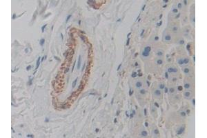 Immunohistochemistry (IHC) image for anti-Actin, gamma 2, Smooth Muscle, Enteric (ACTG2) (AA 3-376) antibody (ABIN7440569)