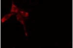 ABIN6269408 staining A549 cells by IF/ICC. (CaMK2 alpha/delta antibody)
