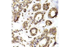 Immunohistochemistry of paraffin-embedded Human mammary gland using RPL13 antibody at dilution of 1:100 (x400 lens). (RPL13 antibody)