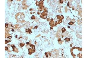Immunohistochemistry (IHC) image for anti-Proopiomelanocortin (POMC) (N-Term) antibody (ABIN6940336)