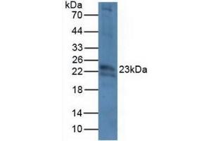 Detection of CRYbB2 in Mouse Eye Tissue using Polyclonal Antibody to Crystallin Beta B2 (CRYbB2) (CRYbB2 antibody  (AA 17-191))