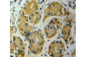 Used in DAB staining on fromalin fixed paraffin-embedded Stomach tissue (ADAMTS12 antibody  (AA 823-997))