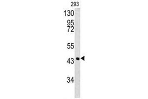 Western blot analysis of SPB3 antibody (N-term) in 293 cell line lysates (35ug/lane). (SERPINB3 antibody  (N-Term))
