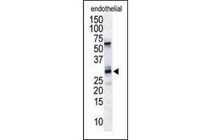 The anti-DSCR1 Pab (ABIN390298 and ABIN2837935) is used in Western blot to detect RCAN1/DSCR1 in endothelial tissue lysate. (RCAN1 antibody  (C-Term))