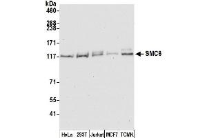 Western Blotting (WB) image for anti-SMC6 Structural Maintenance of Chromosomes 6-Like 1 (SMC6) (C-Term) antibody (ABIN7454597) (SMC6 antibody  (C-Term))