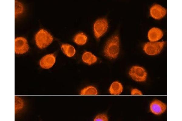 ASPM antibody