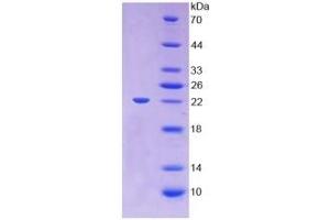 SDS-PAGE of Protein Standard from the Kit (Highly purified E.