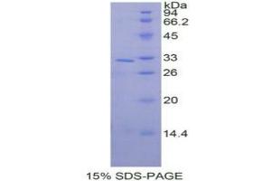 SDS-PAGE analysis of Human MAPK9 Protein.