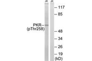 Western blot analysis of extracts from Jurkat cells treated with starved 24h, using PKR (Phospho-Thr258) Antibody. (EIF2AK2 antibody  (pThr258))