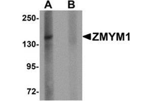 Western blot analysis of ZMYM1 in rat lung tissue lysate with ZMYM1 antibody at 1 μg/ml in (A) the absence and (B) the presence of blocking peptide. (ZMYM1 antibody  (C-Term))