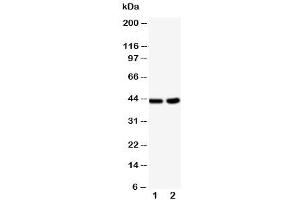 Western blot testing of BCAT1 antibody and Lane 1:  HeLa (BCAT1 antibody  (C-Term))