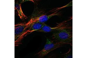 Immunofluorescence analysis of NIH/3T3 cells using GKAP mouse mAb (green). (DLGAP1 antibody)