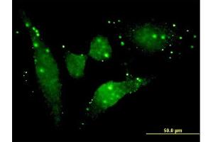 Immunofluorescence of monoclonal antibody to FGFR2 on HeLa cell. (FGFR2 antibody  (AA 621-723))