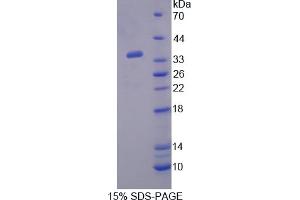 Image no. 1 for Paraoxonase 2 (PON2) (AA 4-289) protein (His tag) (ABIN4989755) (PON2 Protein (AA 4-289) (His tag))