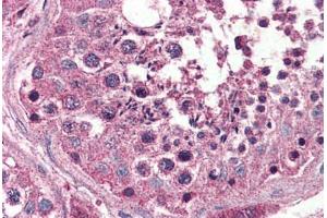 Human Testis (formalin-fixed, paraffin-embedded) stained with OPN3 antibody ABIN399999 at 5 ug/ml followed by biotinylated goat anti-rabbit IgG secondary antibody ABIN481713, alkaline phosphatase-streptavidin and chromogen. (OPN3 antibody  (Internal Region))