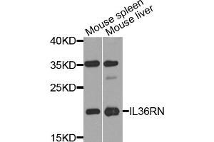 Western blot analysis of extracts of various cell lines, using IL36RN antibody (ABIN5974521) at 1/1000 dilution. (FIL1d antibody)
