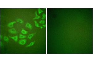 Iunofluorescence analysis of HepG2 cells, using P-10 antibody. (MMP10 antibody)