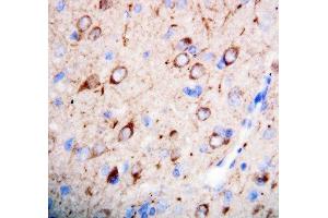 Anti-nNOS(neuronal) antibody, IHC(P) IHC(P): Rat Brain Tissue (NOS1 antibody  (C-Term))