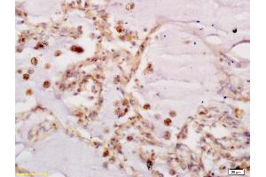 Immunohistochemistry (IHC) image for anti-Frizzled Family Receptor 7 (FZD7) (AA 501-574) antibody (ABIN710051)