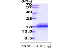 SDS-PAGE (SDS) image for SH2 Domain Containing 1B (SH2D1B) (AA 1-132) protein (His tag) (ABIN5854982)