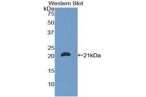 Western Blotting (WB) image for anti-CD8b Molecule (CD8B) (AA 22-170) antibody (ABIN1858318) (CD8B antibody  (AA 22-170))