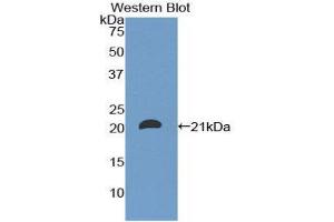 Western Blotting (WB) image for anti-CD8b Molecule (CD8B) (AA 22-170) antibody (ABIN1858318)