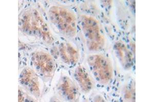 Figure. (CCL4 antibody  (AA 24-92))