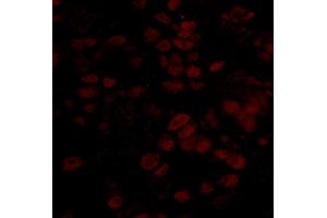 Immunofluorescence (IF) image for anti-BRCA2 and CDKN1A Interacting Protein (BCCIP) (AA 300-350) antibody (ABIN7448933)
