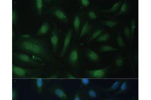 Immunofluorescence analysis of U-2 OS cells using CDKN1B Polyclonal Antibody at dilution of 1:100. (CDKN1B antibody)