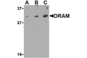 Western blot analysis of DRAM in K562 cell lysate with AP30305PU-N DRAM antibody at (A) 0. (DRAM antibody  (N-Term))