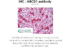 Image no. 1 for anti-ATP-Binding Cassette, Sub-Family D (Ald), Member 1 (ABCD1) antibody (ABIN1731416) (ABCD1 antibody)