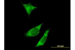 Immunofluorescence of purified MaxPab antibody to RPTOR on HeLa cell. (Raptor antibody  (AA 1-379))