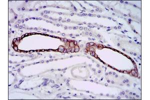 Immunohistochemistry (IHC) image for anti-BPI Fold Containing Family A, Member 2 (BPIFA2) antibody (ABIN1847198) (BPIFA2 antibody)