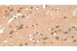 Immunohistochemistry of paraffin-embedded Human brain using CRELD1 Polyclonal Antibody at dilution of 1:40 (CRELD1 antibody)