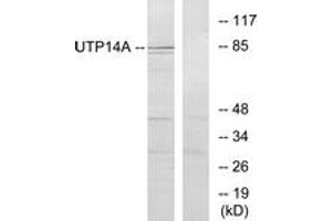 Western blot analysis of extracts from HeLa cells, using UTP14A Antibody. (UTP14A antibody  (AA 321-370))