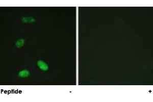 Immunofluorescence analysis of HeLa cells, using MYB polyclonal antibody . (MYB antibody  (Ser12))