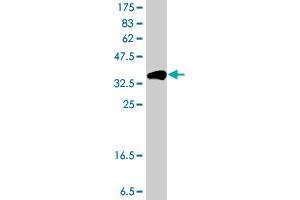 Western Blot detection against Immunogen (36. (KRT16 antibody  (AA 301-398))
