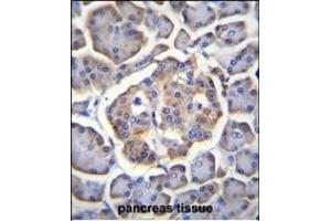 BTBD17 Antibody (C-term) (ABIN655567 and ABIN2845068) immunohistochemistry analysis in formalin fixed and paraffin embedded human pancreas tissue followed by peroxidase conjugation of the secondary antibody and DAB staining. (BTBD17 antibody  (C-Term))
