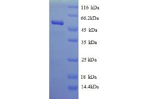 SDS-PAGE (SDS) image for Adenosylhomocysteinase (AHCY) (AA 1-448), (full length) protein (His tag) (ABIN4977079) (AHCY Protein (AA 1-448, full length) (His tag))