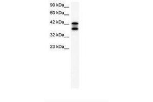 Image no. 2 for anti-Acetyl-CoA Acetyltransferase 2 (ACAT2) (AA 183-232) antibody (ABIN202425)