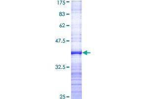 SMC3 Protein (AA 711-810) (GST tag)