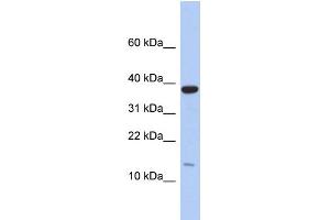 WB Suggested Anti-RPL27 Antibody Titration: 0. (RPL27 antibody  (Middle Region))