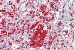 ABIN571240 (3. (IGF1 antibody  (Internal Region))