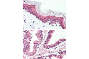 Immunohistochemical staining of human skin (A) and human prostate (B) with GPR126 polyclonal antibody . (G Protein-Coupled Receptor 126 antibody  (N-Term))