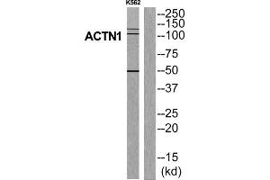 Western Blotting (WB) image for anti-Actinin, alpha 1 (ACTN1) (N-Term) antibody (ABIN1850166) (ACTN1 antibody  (N-Term))