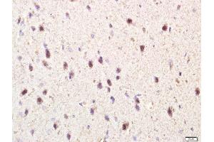 Paraformaldehyde-fixed, paraffin embedded rat brain tissue, Antigen retrieval by boiling in sodium citrate buffer(pH6) for 15min, Block endogenous peroxidase by 3% hydrogen peroxide for 30 minutes, Blocking buffer (normal goat serum) at 37°C for 20min, Antibody incubation with Rabbit Anti-TLR3 Polyclonal Antibody, Unconjugated  at 1:400 overnight at 4°C, followed by a conjugated secondary and DAB staining (TLR3 antibody  (AA 801-905))