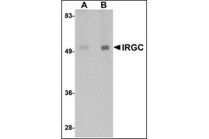 Western blot analysis of IRGC in mouse brain tissue lysate with this product at (A) 1 and (B) 2 μg/ml.