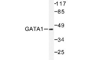 Image no. 1 for anti-GATA Binding Protein 1 (Globin Transcription Factor 1) (GATA1) antibody (ABIN265433) (GATA1 antibody)